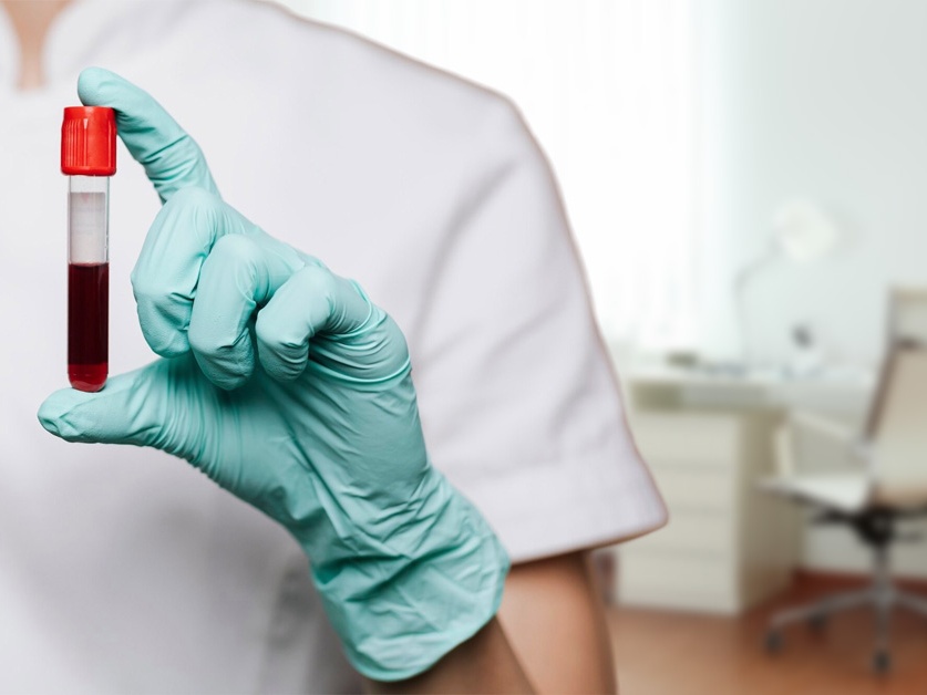 Centrum pro trombózu a hemostázu - Nemocnice Nymburk