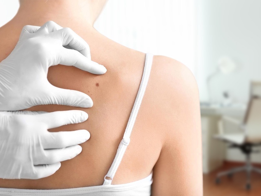 Kožní ordinace - MUDr. Magdalena Nováková